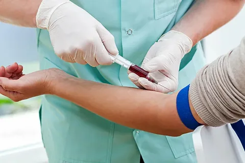 Diagnóstico da hiperidrose em Belo Horizonte - exames para descartar outras condições